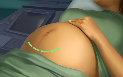 Screenshot 7 for Operate Now Hospital Surgery MOD APK v1.56.1 (Unlimited Money) Android